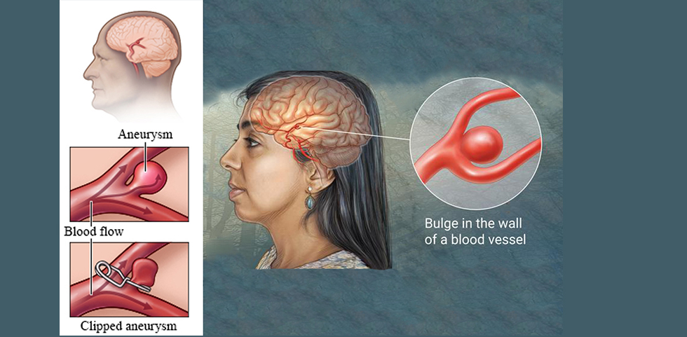 brain infection treatment in borivali mumbai