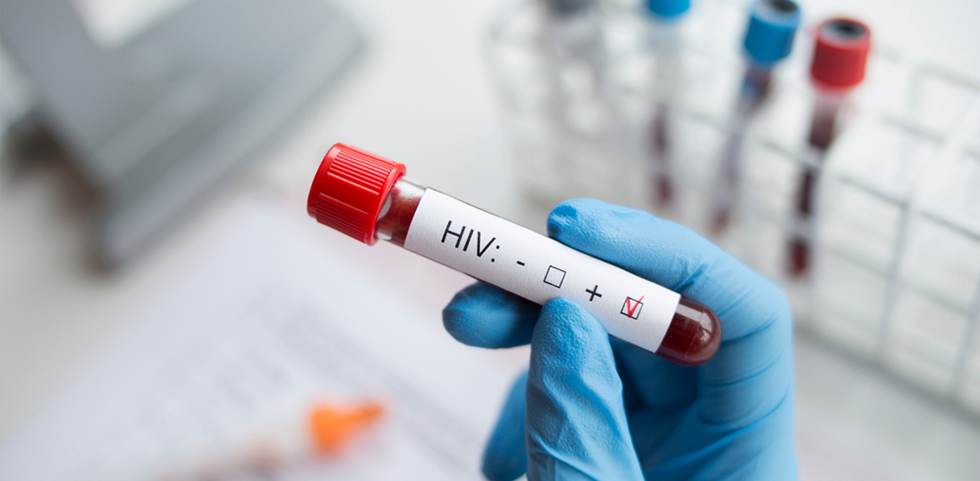 hiv & sexually transmitted diseases treatment in borivali mumbai